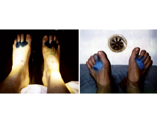 Her/She Senses: Imag(in)ed Malady